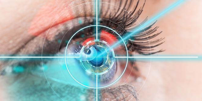 Lasik Laser-in-situ-Keratomileusis