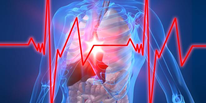 Aortenriss Riss der Aorta