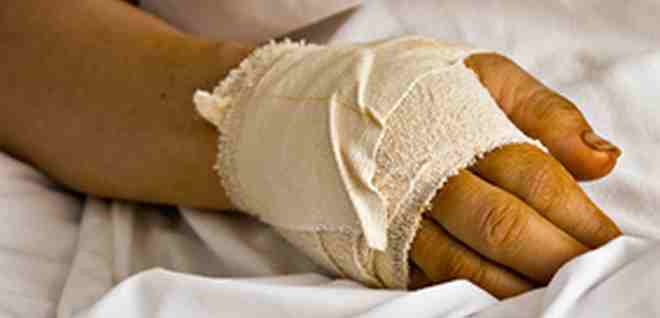 Gips