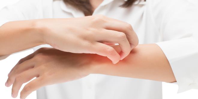 Hautausschlag nach Antibiotika Hautausschlag nach Antibiotika