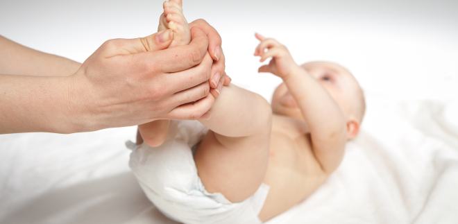 Neurodermitis beim Baby Baby mit Neurodermitis