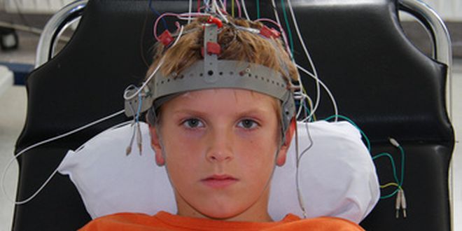 Um eleptische Anfälle zu diagnostizieren, eignet sich das EEG.