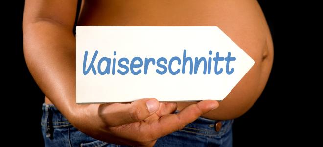 Schmerzen nach Kaiserschnitt