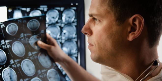Akute Virusenzephalitis Virusinfektion des Gehirns