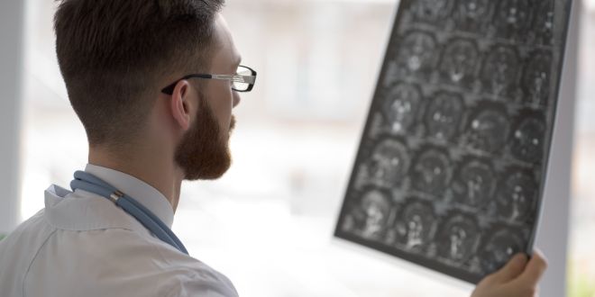 Neurinom Neurilemmom