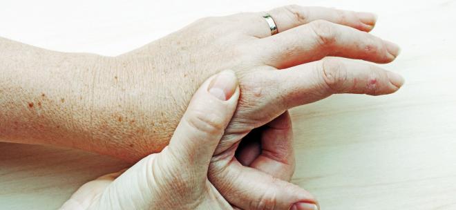 Was ist die Fingerarthrose?