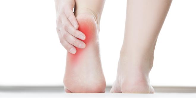 Bei Spreizfüßen kommt es oft zu Schmerzen. Schmerzen sind ein häufiges Symptom von Spreizfüßen.