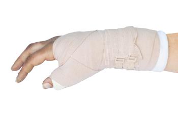 Entzündung im Finger Phlegmone