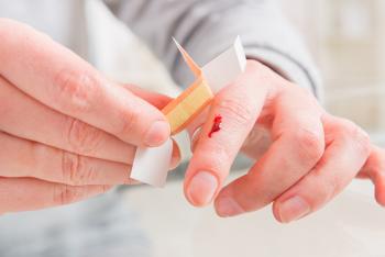 Entzündung im Finger nach Verletzung