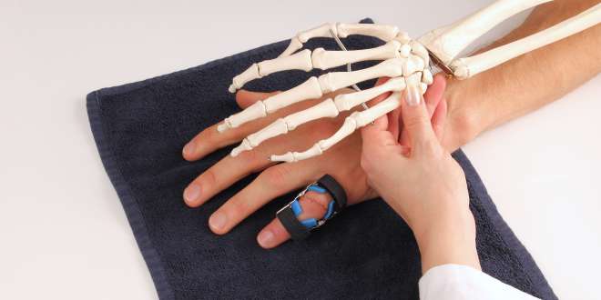 Angeborene Handerkrankungen Angeborene Erkrankungen der Hand