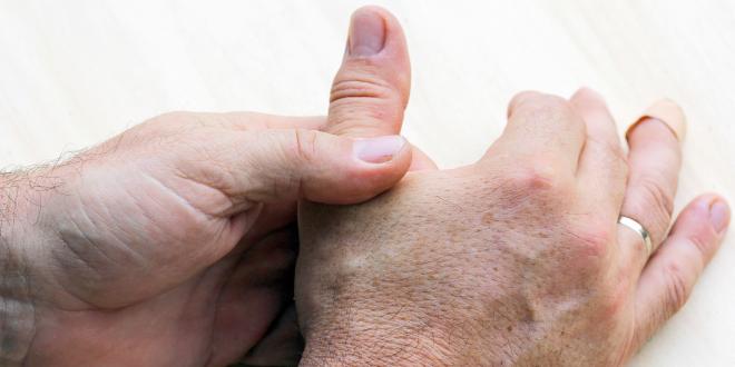 Tendovaginitis (stenosans) de Quervain Tendovaginitis (stenosans) de Quervain