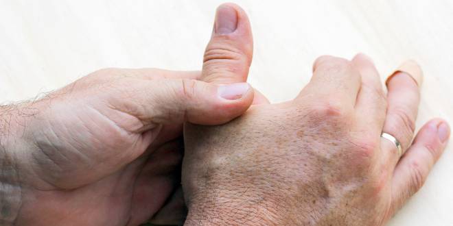 Kapselriss am Finger Finger, Daumen, Hände