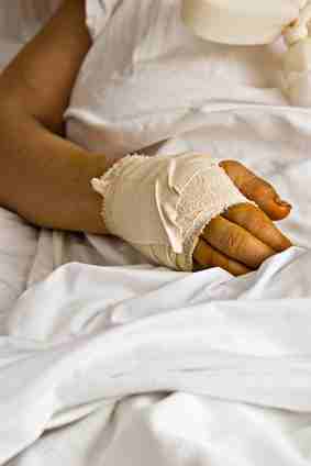 Distale Radiusfraktur Handgelenk mit Gipsverband