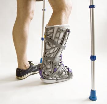Knöchel verstaucht 3 Gips am Fuß