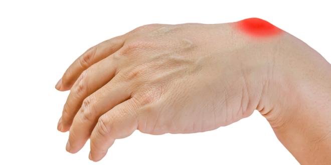 Ganglion