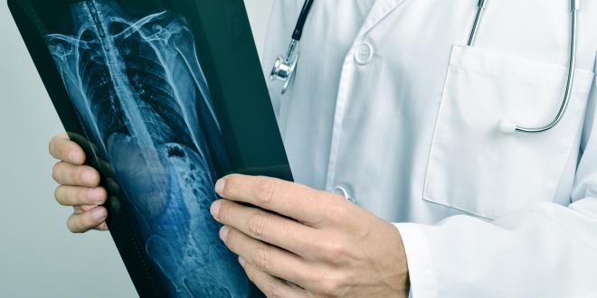 Knorpelschaden im Schultergelenk Röntgen Diagnostik