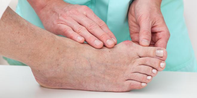 Hallux valgus tapen