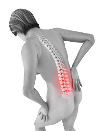 Spinalkanalstenose