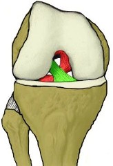 Schmerzen am Knie Schmerzen am Knie