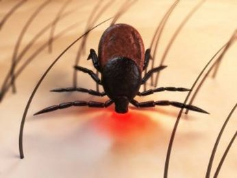Borreliose: Übertragung durch Zecken