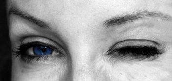 Ptosis Ursachen