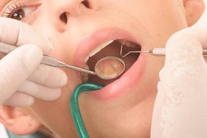 Zahnärztliche Behandlung