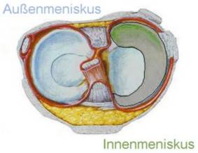 Innenmeniskus und Außenmeniskus