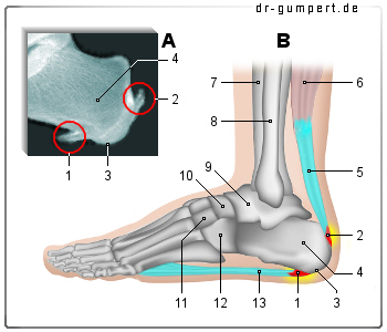 Schmerzen unter der ferse