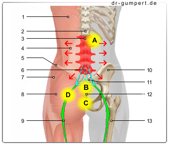 Rückenschmerzen Leiste 