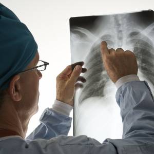 Diagnose eines Facettensyndrom am Röntgenbild