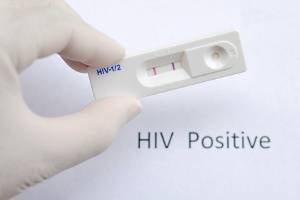 HIV-Test