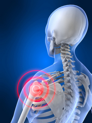 Behandlung des Impingementsyndroms