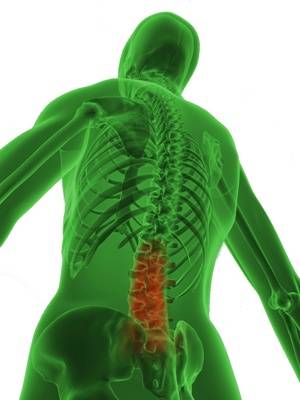 Osteoporose der LWS