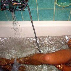Therapie Restless legs
