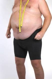 abdominelle Adipositas